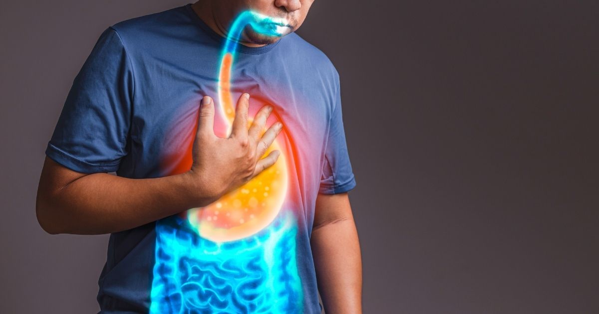Cara Mengatasi Asam Lambung Naik: Panduan Berbasis Bukti