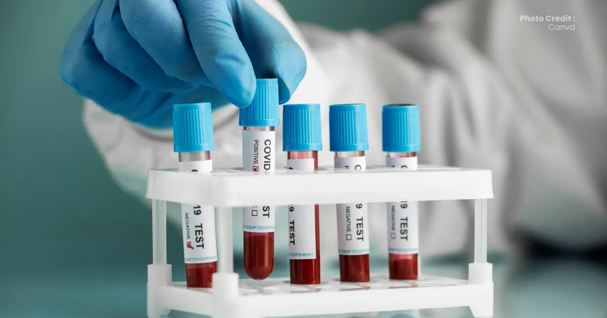 Panduan Pemeriksaan Lab Klinik di Banda Aceh (2026)