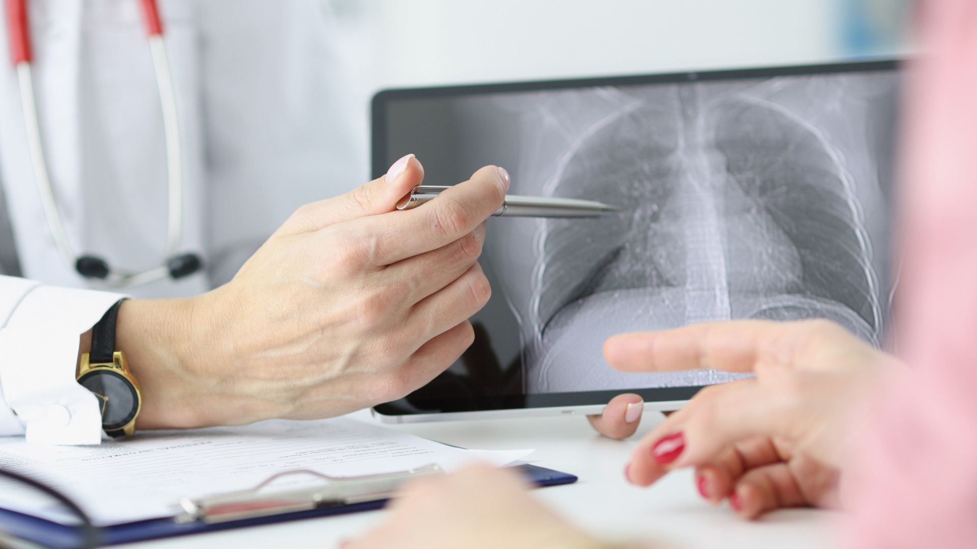 4 Dokter Spesialis Paru di Banda Aceh — RSPUR