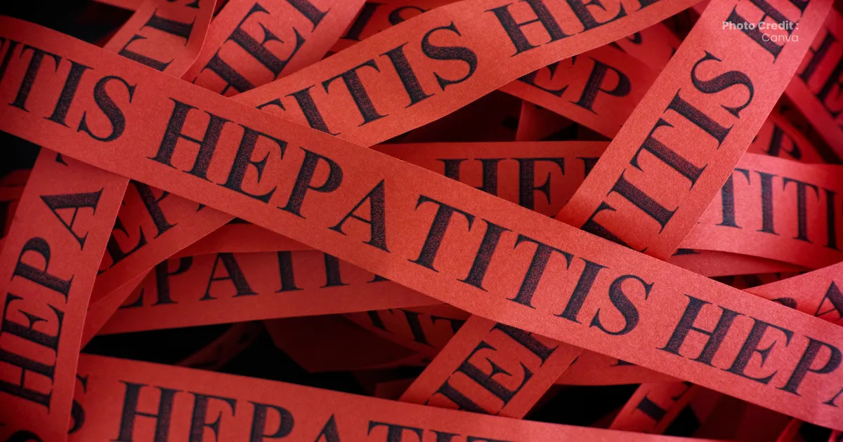 Gejala Hepatitis: Panduan Deteksi Dini Jenis A, B, C, D, E & Kapan Harus ke Dokter Spesialis di Banda Aceh